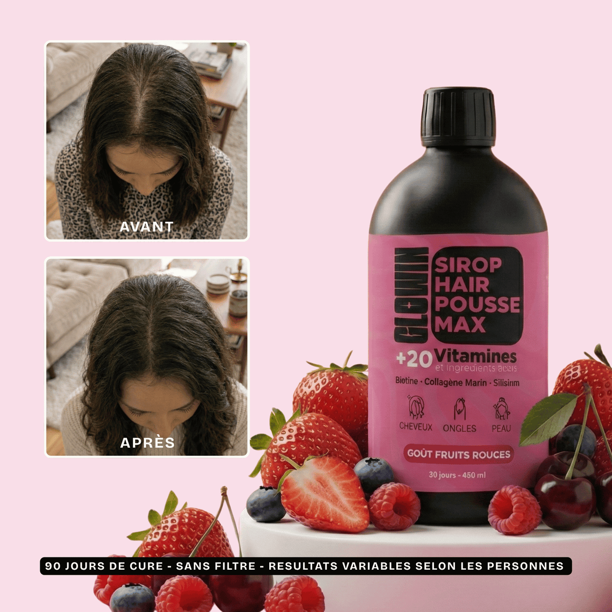 Avant après 90 jours de cure Sirop Hair Pousse Max : densité et longueur des cheveux